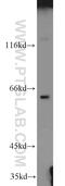 Immunity Related GTPase Q antibody, 23239-1-AP, Proteintech Group, Western Blot image 