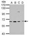 Golgi Associated, Gamma Adaptin Ear Containing, ARF Binding Protein 1 antibody, GTX114175, GeneTex, Western Blot image 