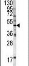 Homeostatic Iron Regulator antibody, PA5-13482, Invitrogen Antibodies, Western Blot image 