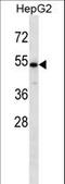 Carbohydrate Sulfotransferase 9 antibody, LS-C159352, Lifespan Biosciences, Western Blot image 