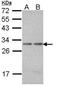 Proteasome Subunit Alpha 7 antibody, orb74182, Biorbyt, Western Blot image 
