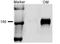 Solute carrier family 12 member 1 antibody, TA326586, Origene, Western Blot image 