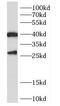 Centromere Protein N antibody, FNab01589, FineTest, Western Blot image 