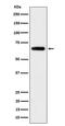 Imp2 antibody, M02010-2, Boster Biological Technology, Western Blot image 