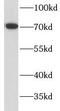 Netrin 1 antibody, FNab09959, FineTest, Western Blot image 