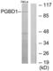 PiggyBac Transposable Element Derived 1 antibody, LS-C119210, Lifespan Biosciences, Western Blot image 