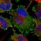 Lipoma-preferred partner antibody, HPA017342, Atlas Antibodies, Immunofluorescence image 