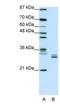 Chloride intracellular channel protein 5 antibody, NBP1-80077, Novus Biologicals, Western Blot image 