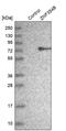 Zinc Finger Protein 354B antibody, PA5-56051, Invitrogen Antibodies, Western Blot image 