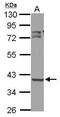3-Oxoacyl-ACP Synthase, Mitochondrial antibody, PA5-32132, Invitrogen Antibodies, Western Blot image 