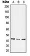 LIM homeobox transcription factor 1-beta antibody, orb214201, Biorbyt, Western Blot image 
