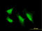 Protein Kinase C Iota antibody, LS-C197989, Lifespan Biosciences, Immunofluorescence image 