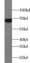 Zinc finger protein 143 antibody, FNab09658, FineTest, Western Blot image 