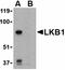 Serine/Threonine Kinase 11 antibody, orb74779, Biorbyt, Western Blot image 