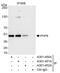 PHD Finger Protein 6 antibody, A301-451A, Bethyl Labs, Immunoprecipitation image 