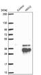 H6 Family Homeobox 2 antibody, NBP1-91997, Novus Biologicals, Western Blot image 