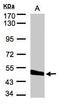 Probable serine carboxypeptidase CPVL antibody, TA308148, Origene, Western Blot image 