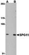 SPG11 Vesicle Trafficking Associated, Spatacsin antibody, orb75142, Biorbyt, Western Blot image 