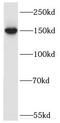 ERCC Excision Repair 6, Chromatin Remodeling Factor antibody, FNab02835, FineTest, Western Blot image 