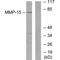 Matrix Metallopeptidase 15 antibody, A06396, Boster Biological Technology, Western Blot image 