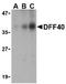 DNA Fragmentation Factor Subunit Beta antibody, TA306009, Origene, Western Blot image 