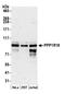 Protein Phosphatase 1 Regulatory Subunit 18 antibody, A305-614A-M, Bethyl Labs, Western Blot image 