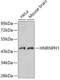 Heterogeneous nuclear ribonucleoprotein H antibody, 19-946, ProSci, Western Blot image 