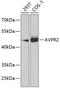 DIR antibody, GTX55528, GeneTex, Western Blot image 