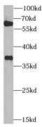 Zinc Finger Protein 346 antibody, FNab09688, FineTest, Western Blot image 