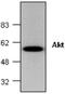 Akt antibody, GTX59640, GeneTex, Western Blot image 