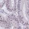 Ribosome biogenesis protein BOP1 antibody, HPA047869, Atlas Antibodies, Immunohistochemistry paraffin image 
