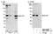 BRCA2 And CDKN1A Interacting Protein antibody, NBP1-22993, Novus Biologicals, Western Blot image 