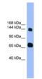 Pleckstrin Homology And RhoGEF Domain Containing G2 antibody, NBP1-69100, Novus Biologicals, Western Blot image 