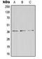Zinc Finger DHHC-Type Containing 9 antibody, LS-C353431, Lifespan Biosciences, Western Blot image 
