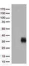 HLA class II histocompatibility antigen, DQ alpha 2 chain antibody, CF812936, Origene, Western Blot image 