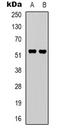 Endothelin B receptor-like protein 2 antibody, LS-C368975, Lifespan Biosciences, Western Blot image 
