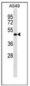 Leucine Rich Repeat Containing 26 antibody, AP52529PU-N, Origene, Western Blot image 