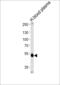 Serpin Family F Member 1 antibody, MBS9202254, MyBioSource, Western Blot image 