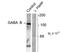 Gamma-aminobutyric acid type B receptor subunit 1 antibody, TA309144, Origene, Western Blot image 