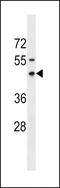 Ring Finger Protein, Transmembrane 1 antibody, LS-C158880, Lifespan Biosciences, Western Blot image 