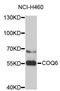 Ubiquinone biosynthesis monooxygenase COQ6 antibody, abx126871, Abbexa, Western Blot image 