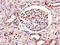 SWI5 Homologous Recombination Repair Protein antibody, CSB-PA636328LA01HU, Cusabio, Immunohistochemistry paraffin image 