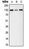 EPHB1 antibody, LS-C354237, Lifespan Biosciences, Western Blot image 