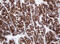 Amylase Alpha 2B (Pancreatic) antibody, M09355, Boster Biological Technology, Immunohistochemistry paraffin image 