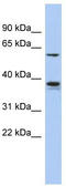 PIST antibody, TA336075, Origene, Western Blot image 