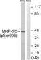 Dual Specificity Phosphatase 1 antibody, PA5-39795, Invitrogen Antibodies, Western Blot image 