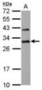 DRP1 antibody, NBP2-16148, Novus Biologicals, Western Blot image 
