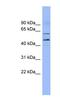 Lipase Maturation Factor 1 antibody, NBP1-62445, Novus Biologicals, Western Blot image 