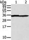 STX3 antibody, PA5-50837, Invitrogen Antibodies, Western Blot image 