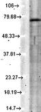 Potassium Voltage-Gated Channel Subfamily Q Member 4 antibody, orb67399, Biorbyt, Western Blot image 